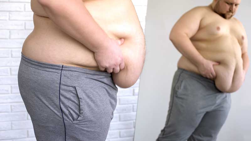 liposuction men