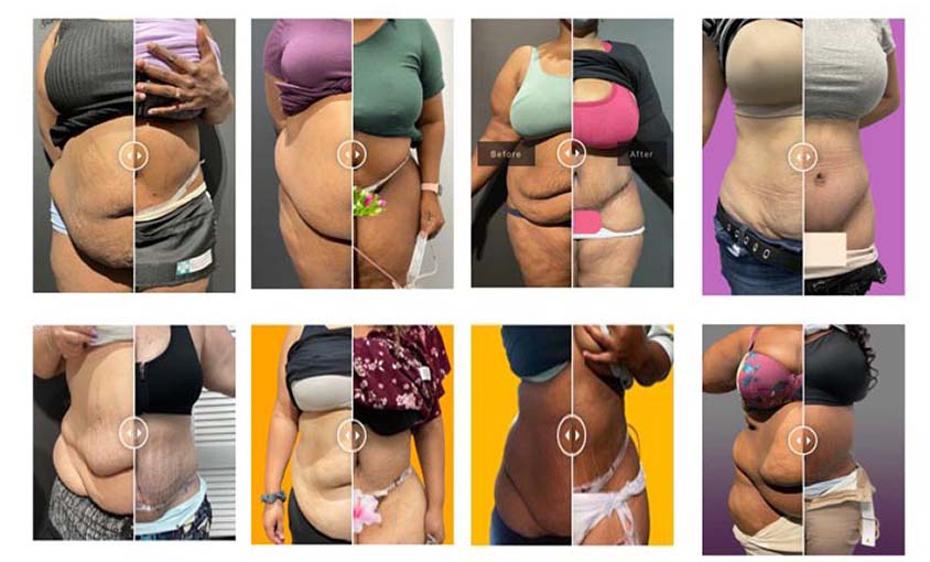 before and after photos